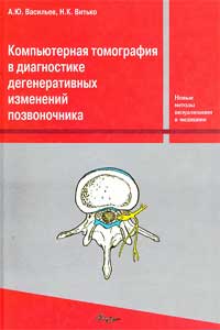 Компьютерная томография в диагностике дегенеративных изменений позвоночника — обложка книги.