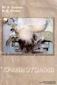 Краниотомия — обложка книги.